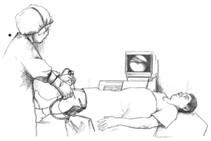 Arthroscopy.png