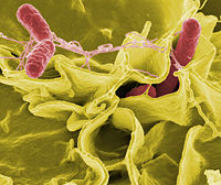 Color-enhanced scanning electron micrograph showing Salmonella typhimurium (red) invading cultured human cells