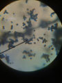 Aspergillus black mold microscopic view