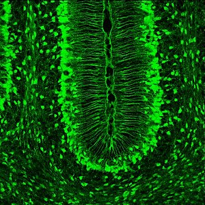 Slcla3 in Bergmann Glia.jpg